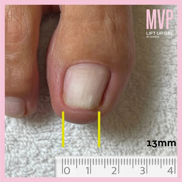 Lift Up MVP Care Gel Kit