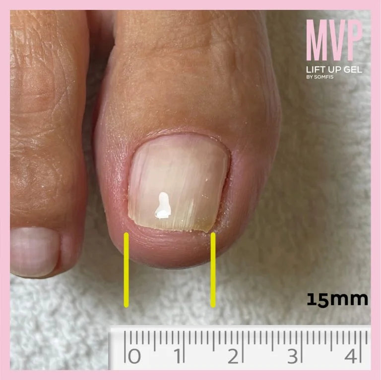 Lift Up MVP Care Gel Kit