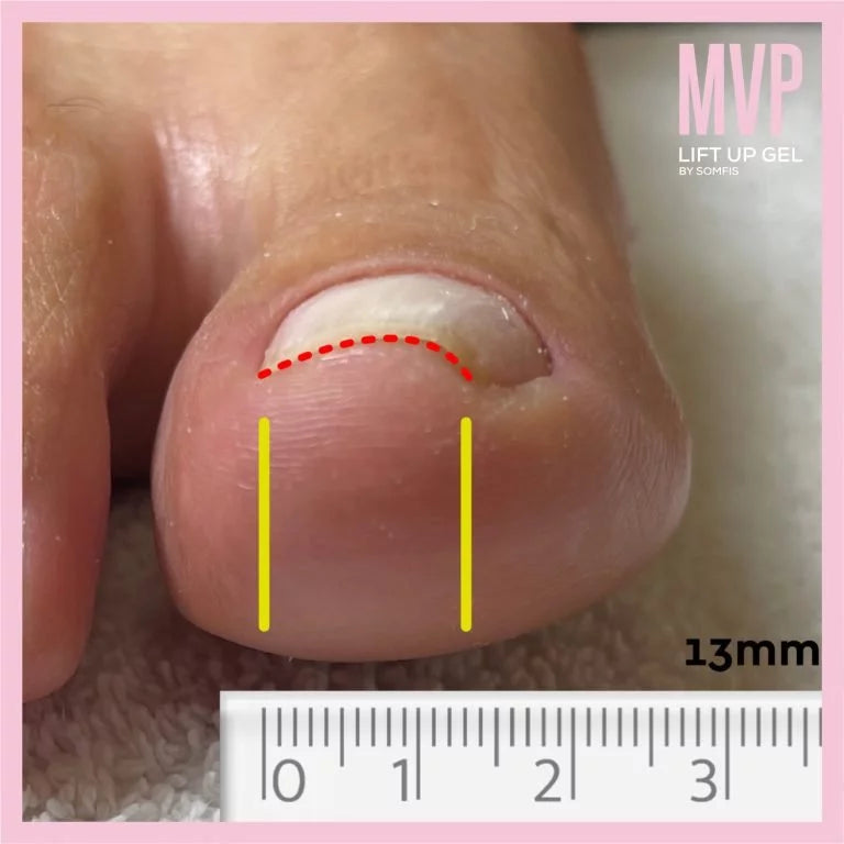 Lift Up MVP Care Gel Kit